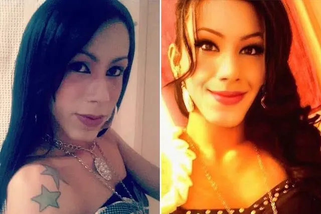 Güzellik uğruna yüzü tanınmaz hale geldi! Yine akıllanmadı