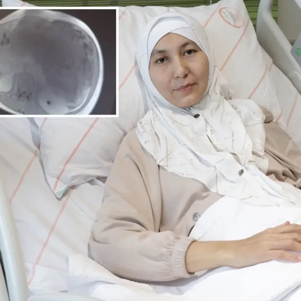 Kazakistanlı kadının karnından yaklaşık 45 santimetrelik tümör çıkarıldı