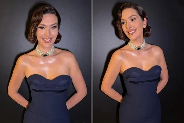 Bergüzar Korel'in 20 Kilo Vermesinin Ardındaki Sır