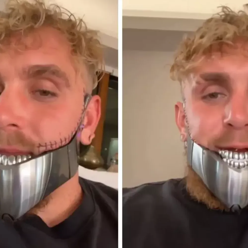 Bir maçla 92 milyon dolar kazanmıştı! Çenesi kırılan Jake Paul ikinci kez ameliyat oldu
