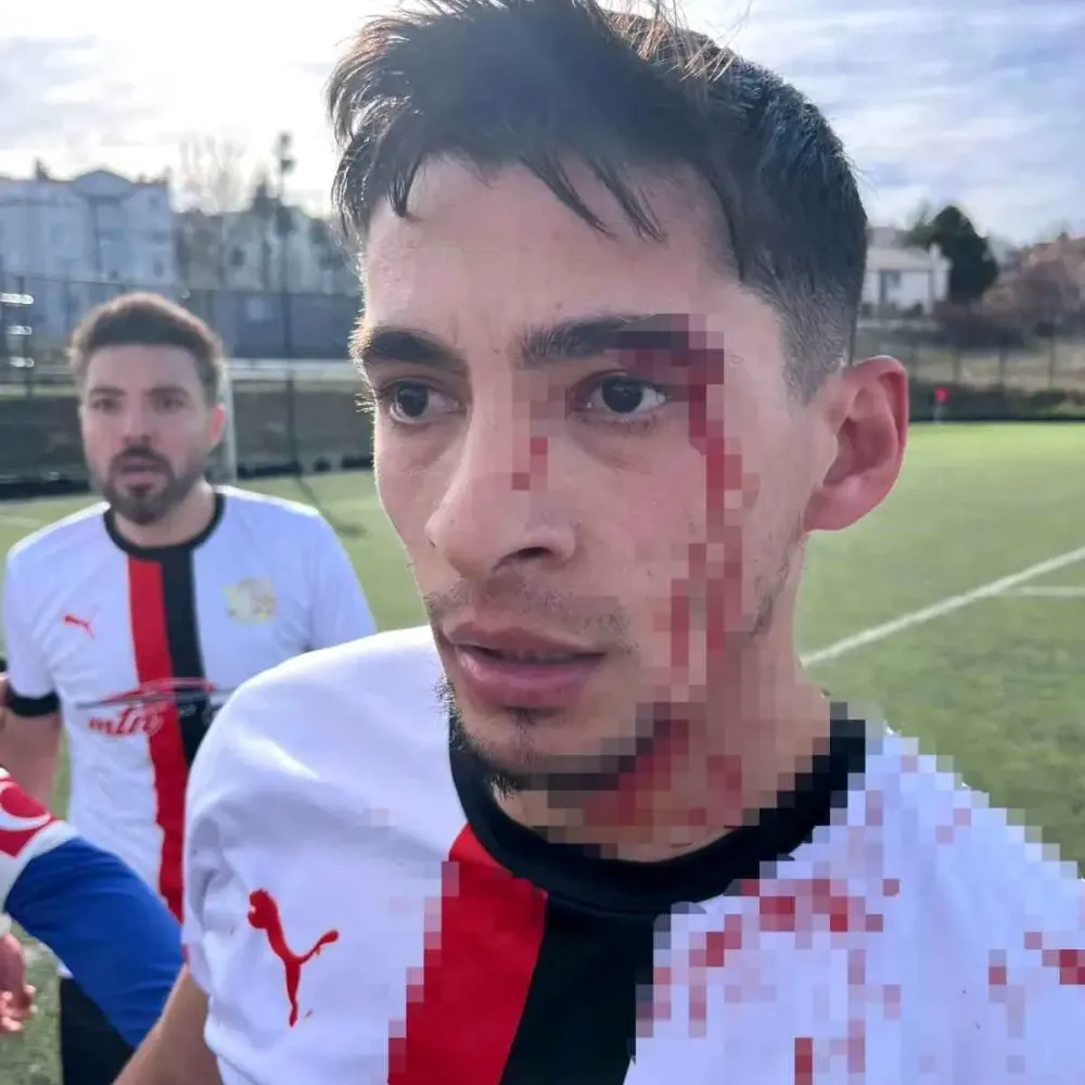 Maç sonrası saha içi savaş alanına döndü, 3 futbolcu hastanelik oldu